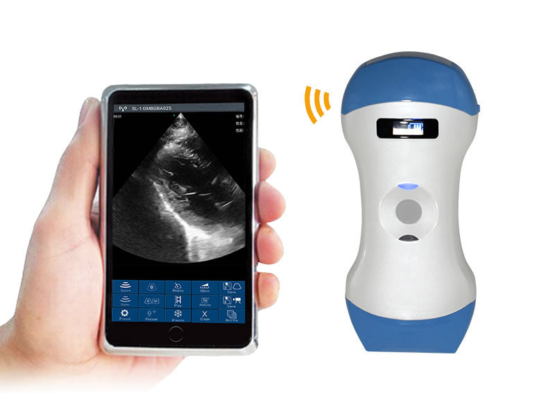 C4PL 128 Elements Portable Double Head Waterproof Mini Wifi Color Doppler Wireless Linear & Convex Ultrasound Probe wireless