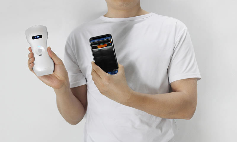 6CPL 192 Elements 3in1 palm doppler ultrasound, convex/linear/phased array three-in-one, high configuration