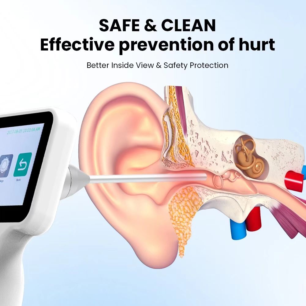 Wireless hd video otoscope rigid video otoscope large screen vet video otoscope