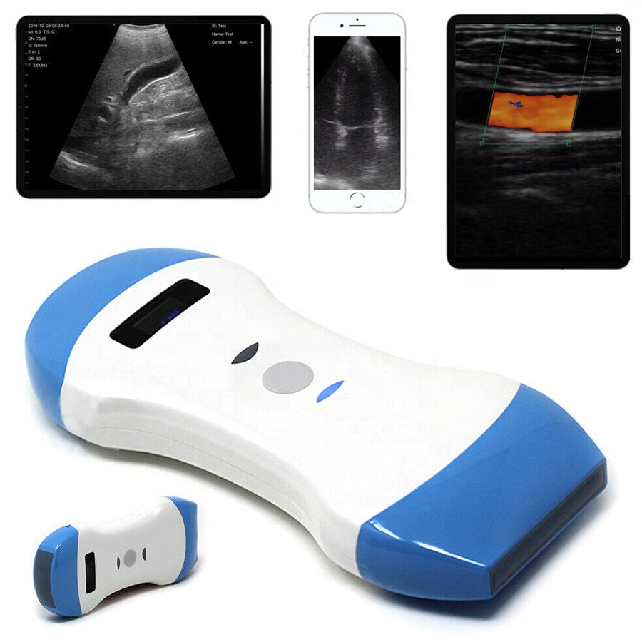 C4PL 128 Elements Portable Double Head Waterproof Mini Wifi Color Doppler Wireless Linear & Convex Ultrasound Probe wireless