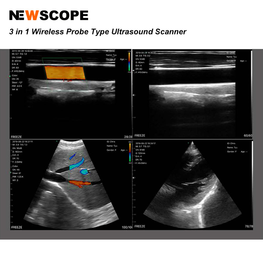 C4PL 128 Elements Portable Double Head Waterproof Mini Wifi Color Doppler Wireless Linear & Convex Ultrasound Probe wireless
