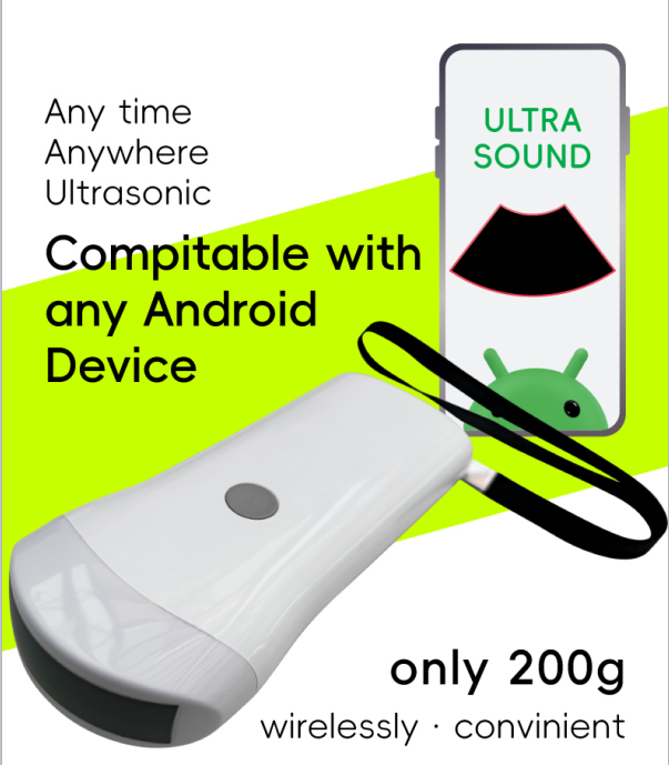 3.5MHz Convex Probe 80 Probe Elements 8 Channels Wireless Handheld Ultrasound