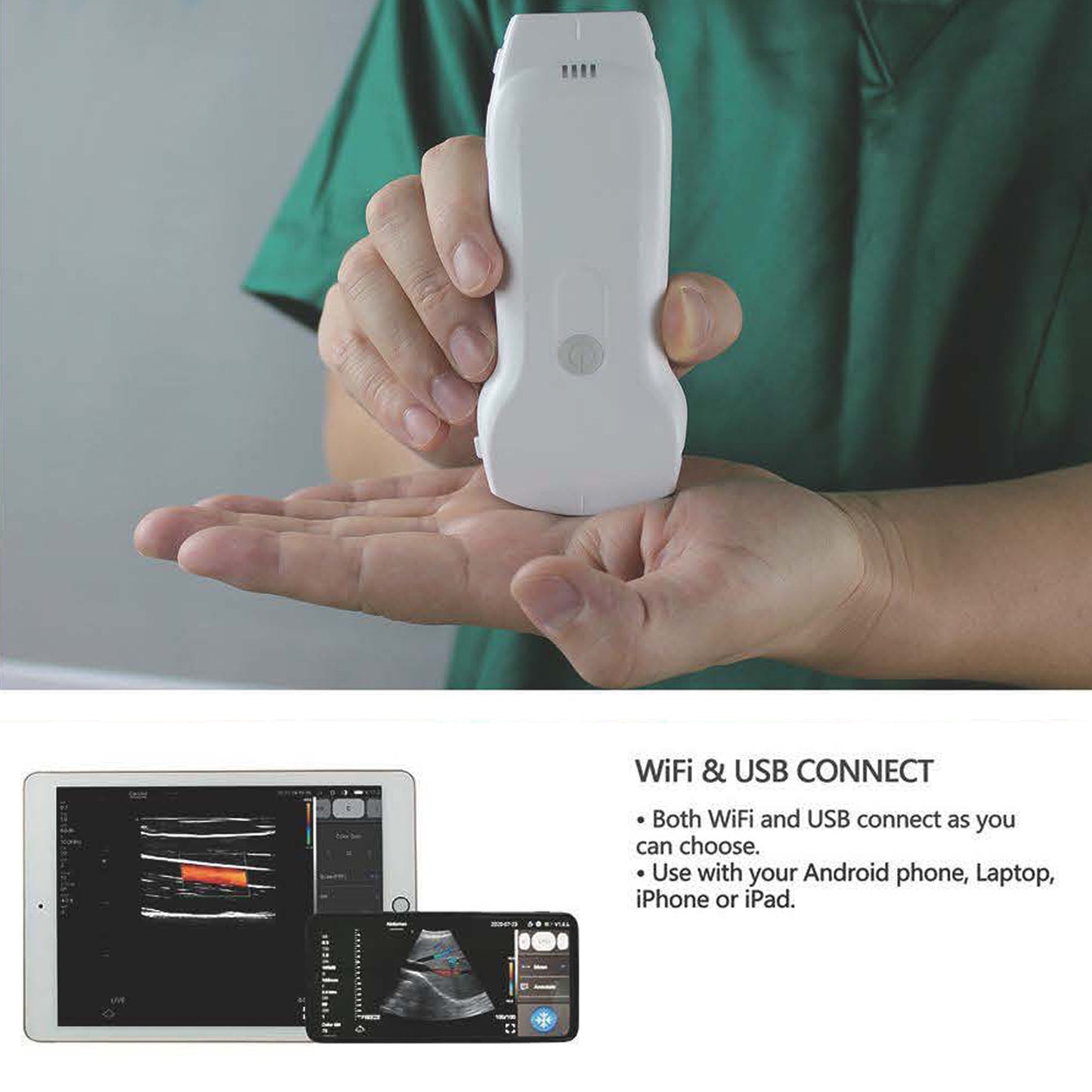 3-in-1 Double Heads 128 Elements Color Doppler Wireless Ultrasound Probe Convex/Linear/Phased array support iOS Android Windows