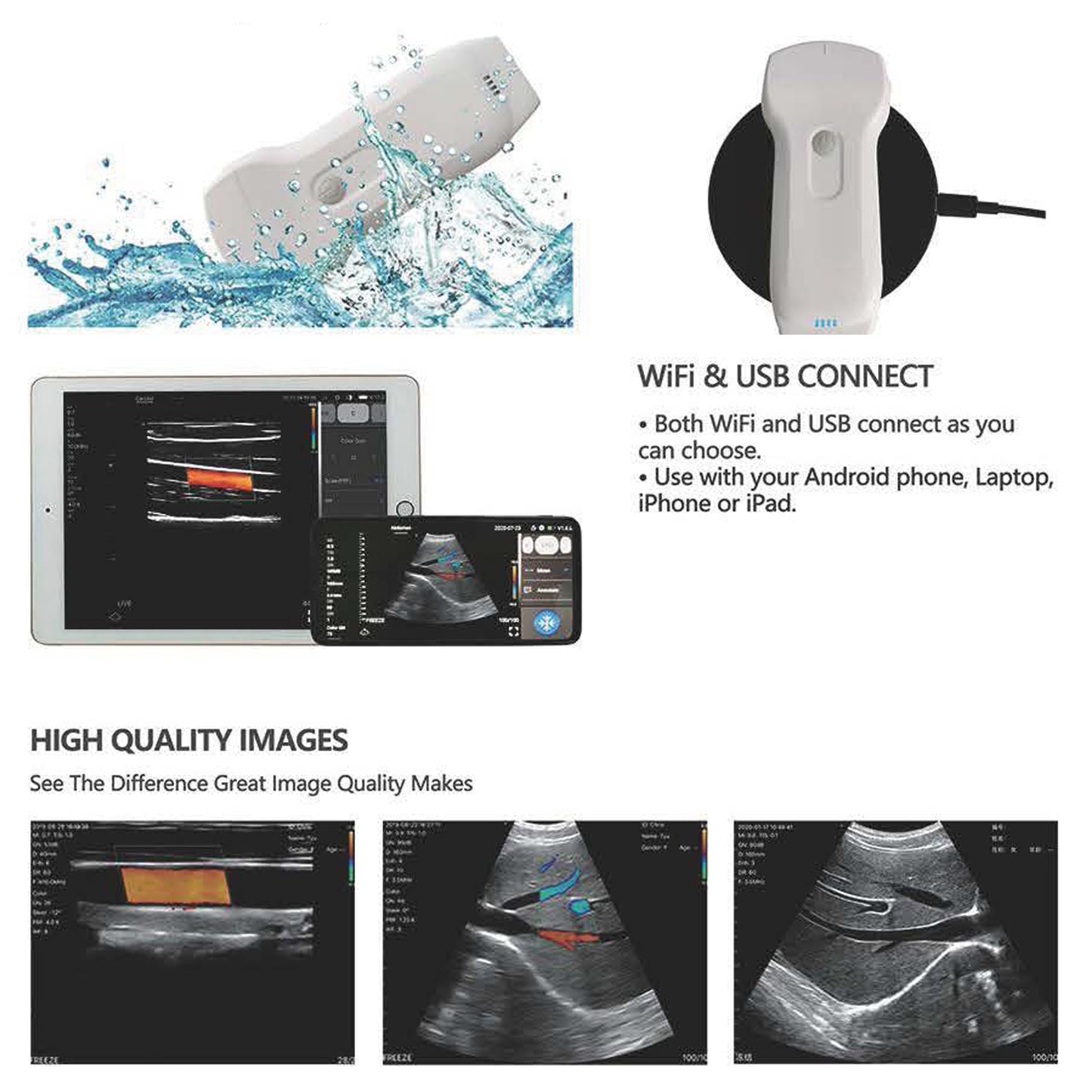 3-in-1 Double Heads 128 Elements Color Doppler Wireless Ultrasound Probe Convex/Linear/Phased array support iOS Android Windows