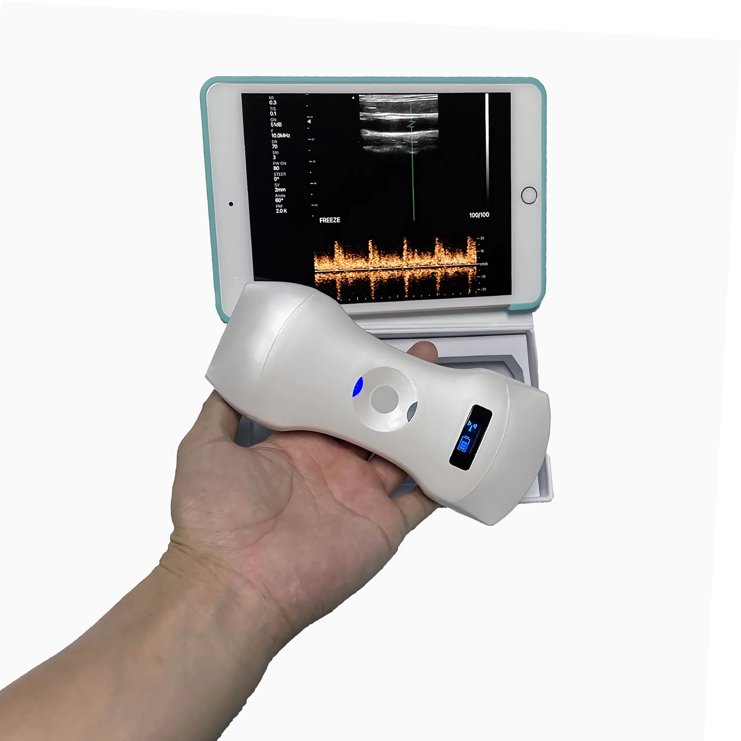 6CPL 192 Elements 3in1 palm doppler ultrasound, convex/linear/phased array three-in-one, high configuration