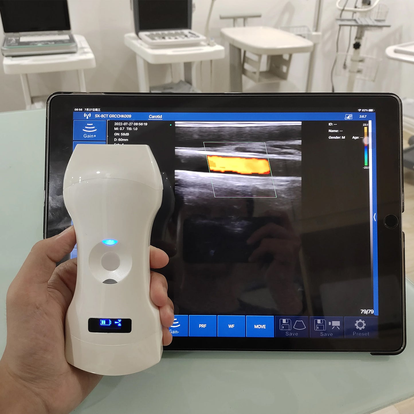 6CPL 192 Elements 3in1 palm doppler ultrasound, convex/linear/phased array three-in-one, high configuration