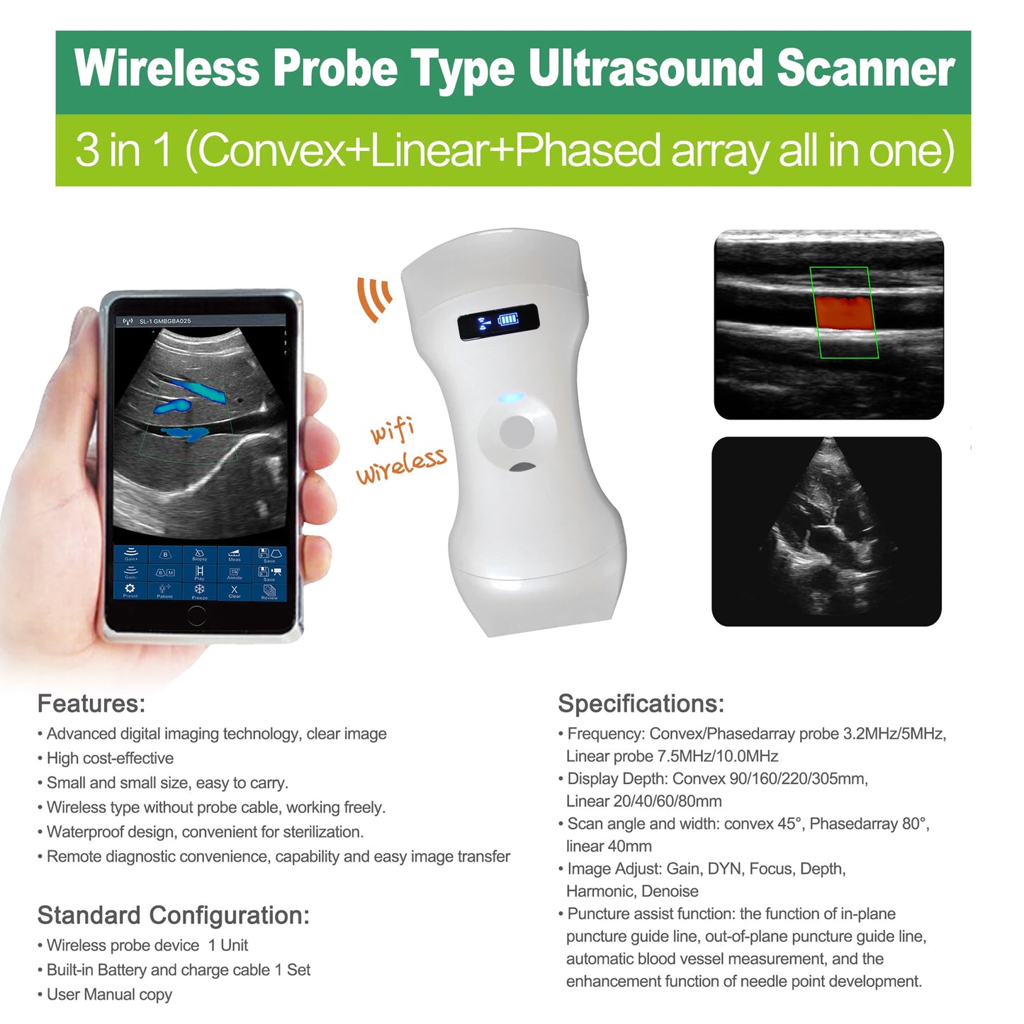 6CPL 192 Elements 3in1 palm doppler ultrasound, convex/linear/phased array three-in-one, high configuration