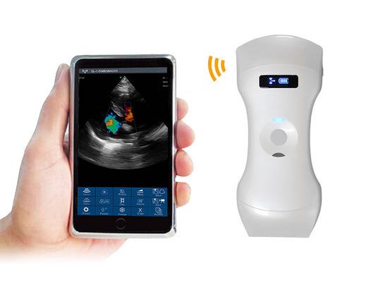 6CPL 192 Elements 3in1 palm doppler ultrasound, convex/linear/phased array three-in-one, high configuration