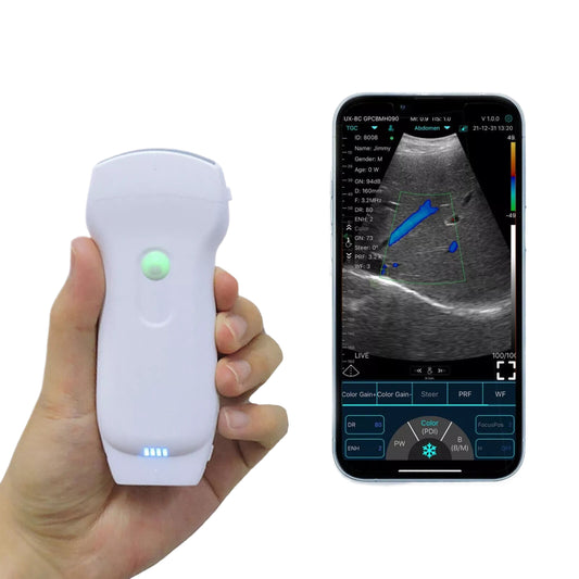 3-in-1 Double Heads 128 Elements Color Doppler Wireless Ultrasound Probe Convex/Linear/Phased array support iOS Android Windows